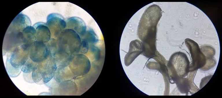 Zdrijelna zlijezda 1